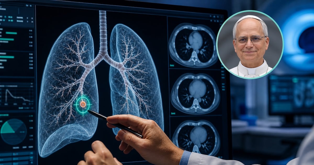 Nódulo pulmonar: cuando un hallazgo de tres milímetros alcanza para pasar por el quirófano