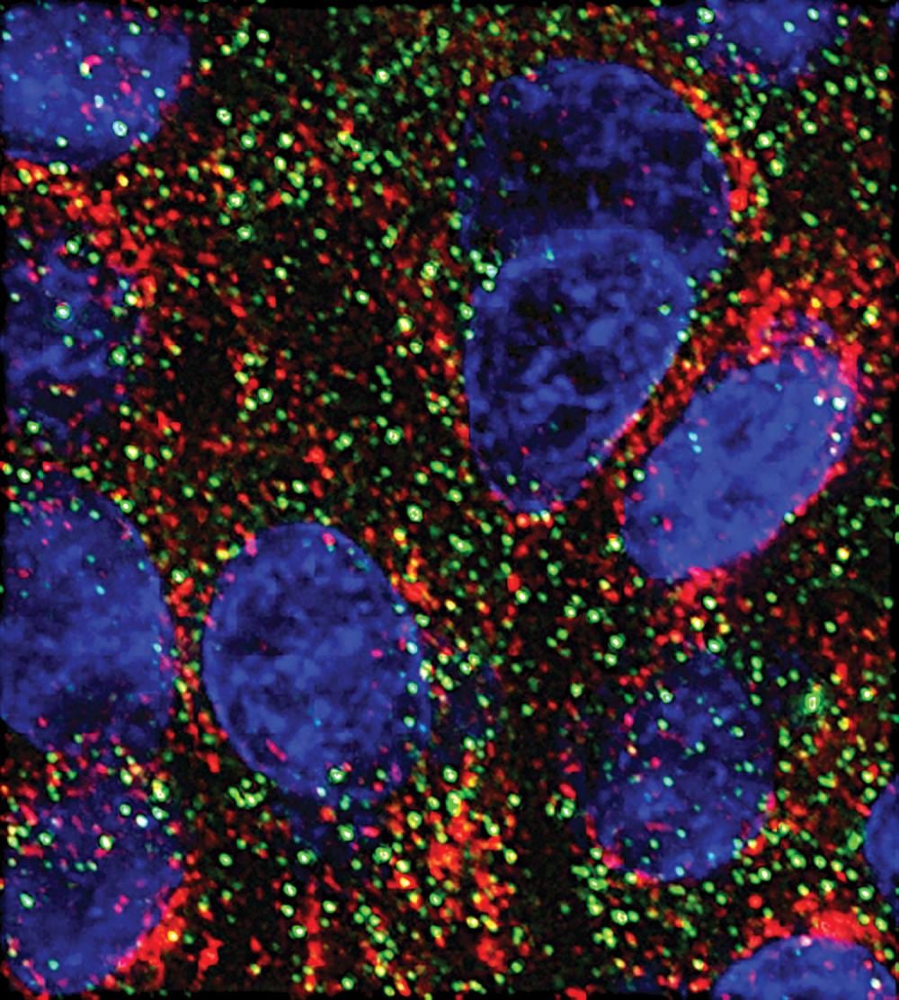 Una pista de laboratorio contra el cáncer de páncreas